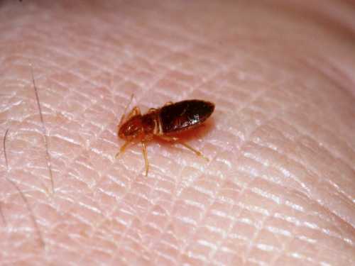 Снять зуд от укусов насекомых, которые оставляют после себя и серьезные отметины, поможет меновазин